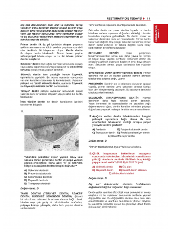 Tüm Dus Soruları 1+2 ( 2.Cilt ) Klinik Bilimler - 1