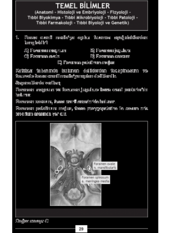 NİSAN 2013 DUS SORULARI ve Detaylı Açıklamaları