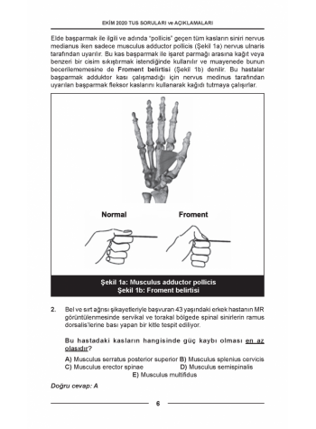 EKİM 2020 ÖSYM'nin Orijinal TUS SORULARI EKİM 2020 ÖSYM'nin Orijinal TUS SORULARI