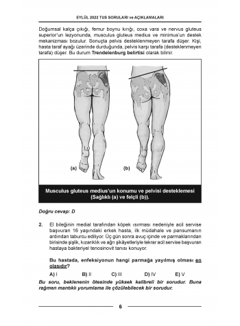 Eylül 2022 ÖSYM nin Orijinal TUS Soruları Eylül 2022 ÖSYM nin Orijinal TUS Soruları