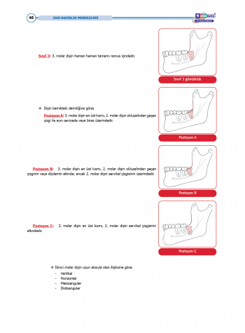 DUS Şampiyonların Notu - Ağız Cerrahisi ( 2025 )