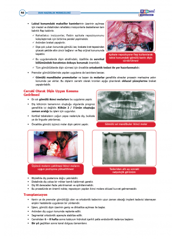 DUS Şampiyonların Notu - Ağız Cerrahisi ( 2025 )