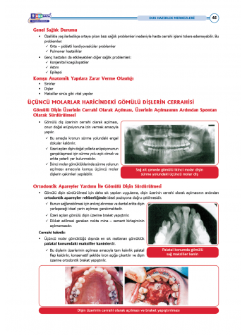 DUS Şampiyonların Notu - Ağız Cerrahisi ( 2025 )