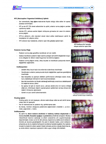 DUS Şampiyonların Notu - Protetik Diş ( 2025 )