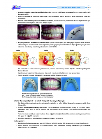 DUS Şampiyonların Notu - Protetik Diş ( 2025 )