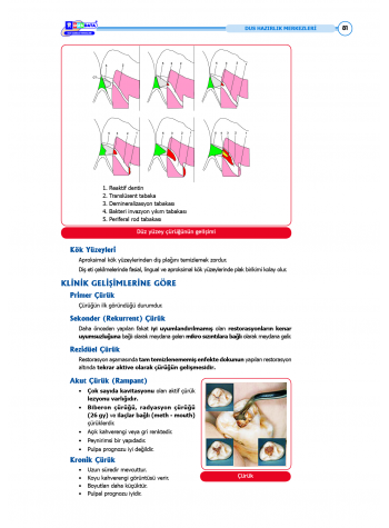 DUS Şampiyonların Notu ( 17.Baskı ) Restoratif Diş
