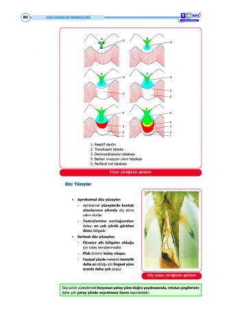 DUS Şampiyonların Notu ( 17.Baskı ) Restoratif Diş