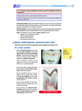 DUS Şampiyonların Notu ( 17.Baskı ) Restoratif Diş
