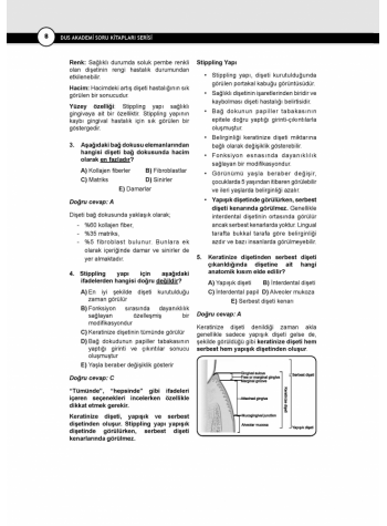 DUS Akademi Soru ( 2.Baskı ) PERİODONTOLOJİ