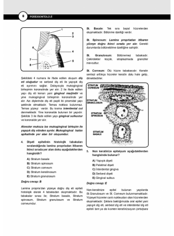 DUS Miadent Soru ( 5.Baskı ) Periodontoloji