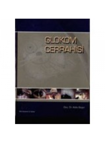 Glokom Cerrahisi