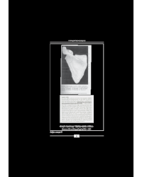 Mayıs 2011 Açıklamalı Tus Soruları