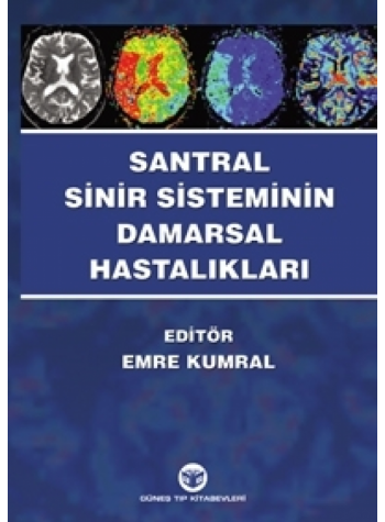 Santral Sinir Sisteminin Damarsal