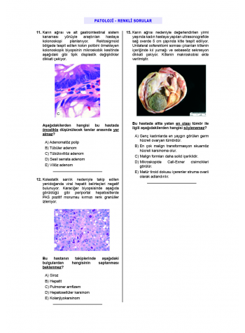 24 Açıklamalı Deneme Serisi 3.Baskı - Patoloji