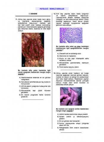 24 Açıklamalı Deneme Serisi 3.Baskı - Patoloji