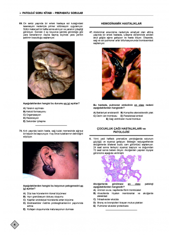Klinisyen Prime Soruları Patoloji ( 21.Baskı ) Klinisyen Prime Soruları Patoloji ( 21.Baskı )