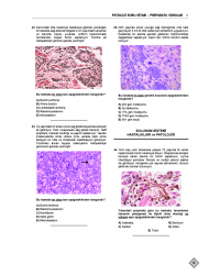 Klinisyen Prime Soruları Patoloji ( 21.Baskı )
