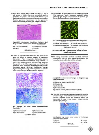 Klinisyen Prime Soruları Patoloji ( 21.Baskı )