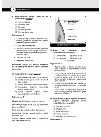 DUS Miadent Soru ( 5.Baskı ) Periodontoloji