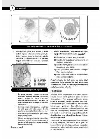 DUS Miadent Soruları ( 7.Baskı ) Endodonti