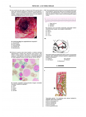 Pretus Deneme Sınavları - 200 ( 2.Cilt ) Pretus Deneme Sınavları - 200 ( 2.Cilt )