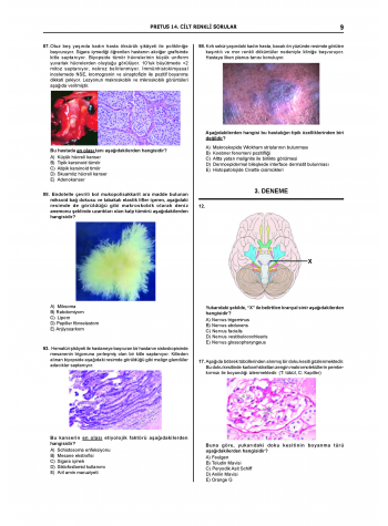 Pretus Deneme Sınavları / 14.Cilt