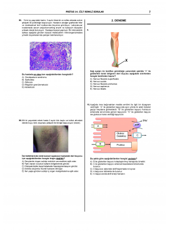 Pretus Deneme Sınavları / 14.Cilt