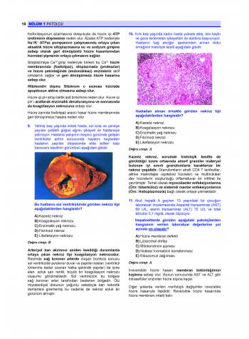Prospektus Soruları Patoloji