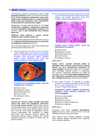 Prospektus Soruları Patoloji Prospektus Soruları Patoloji